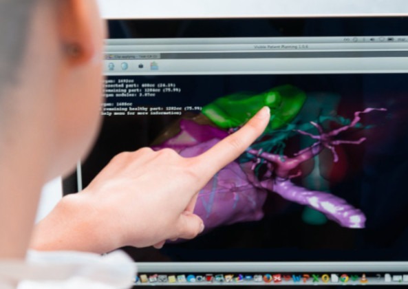 Intervention chez Visible Patient